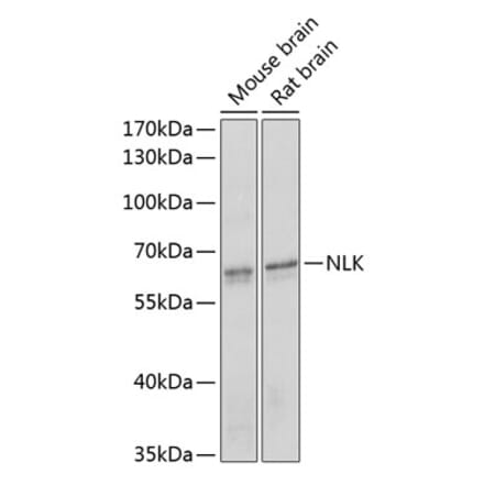 Western Blot - Anti-NLK Antibody (A14401) - Antibodies.com