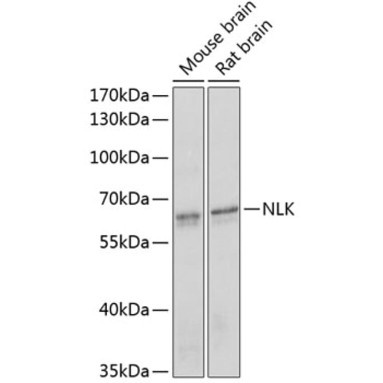 Western Blot - Anti-NLK Antibody (A14401) - Antibodies.com