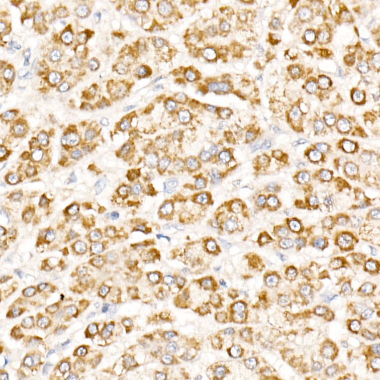 Immunohistochemistry - Anti-NLK Antibody (A14401) - Antibodies.com