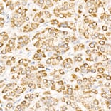 Immunohistochemistry - Anti-NLK Antibody (A14401) - Antibodies.com