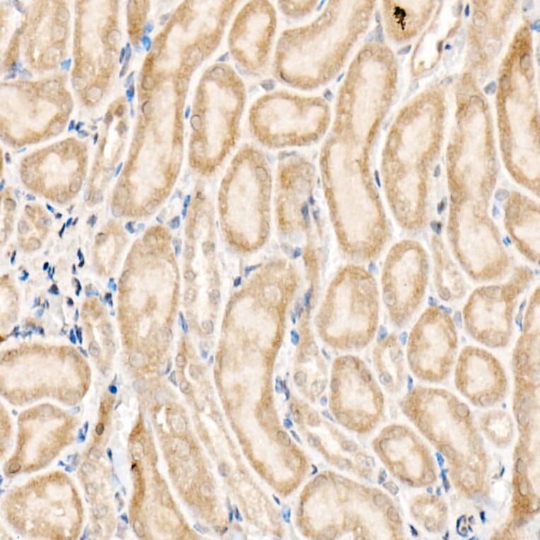 Immunohistochemistry - Anti-NLK Antibody (A14401) - Antibodies.com