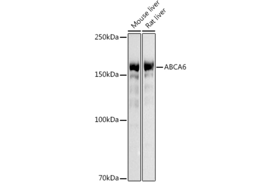 Western Blot - Anti-ABCA6 Antibody (A14402) - Antibodies.com