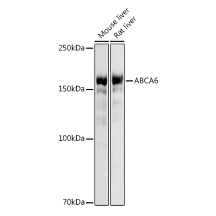 Western Blot - Anti-ABCA6 Antibody (A14402) - Antibodies.com