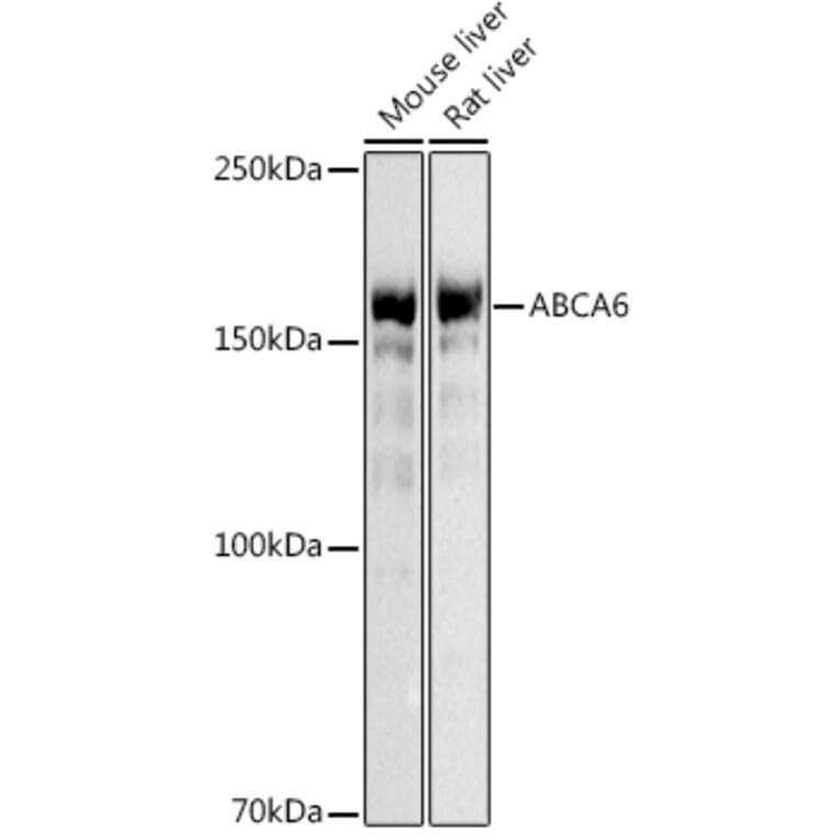 Western Blot - Anti-ABCA6 Antibody (A14402) - Antibodies.com