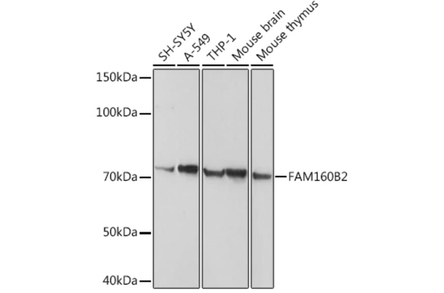 Western Blot - Anti-FHIP2B Antibody (A14403) - Antibodies.com