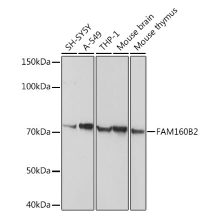 Western Blot - Anti-FHIP2B Antibody (A14403) - Antibodies.com