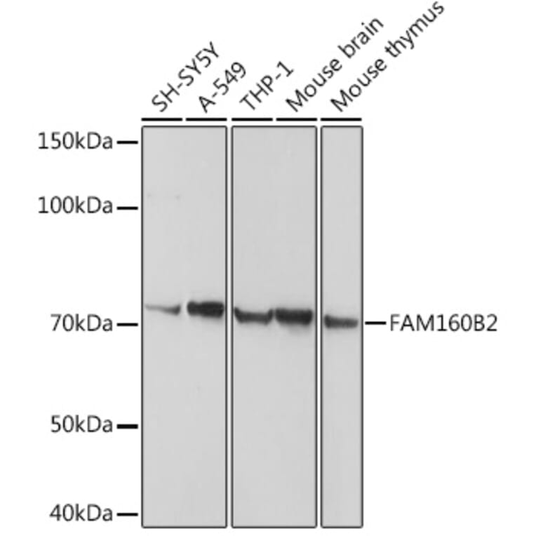 Western Blot - Anti-FHIP2B Antibody (A14403) - Antibodies.com