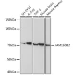 Western Blot - Anti-FHIP2B Antibody (A14403) - Antibodies.com