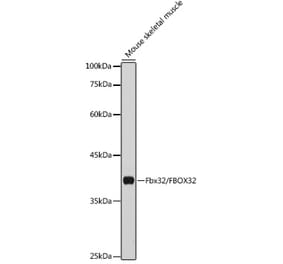 Western Blot - Anti-Fbx32 Antibody (A14404) - Antibodies.com