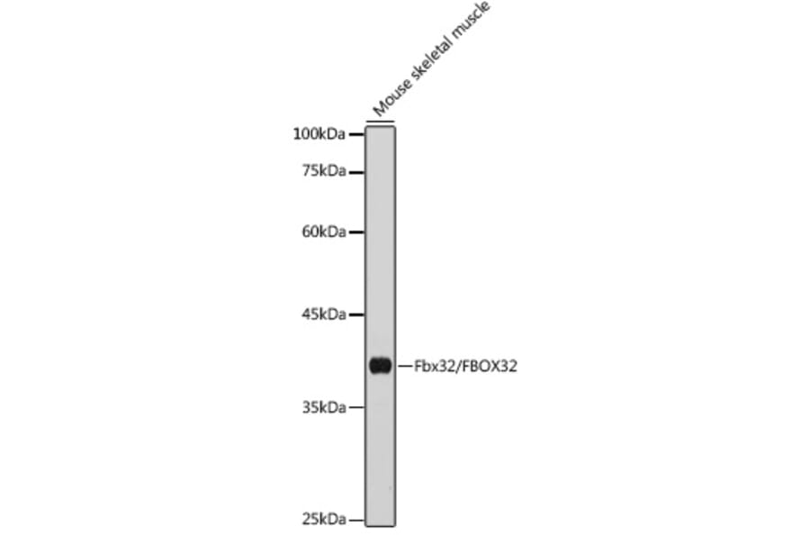 Western Blot - Anti-Fbx32 Antibody (A14404) - Antibodies.com