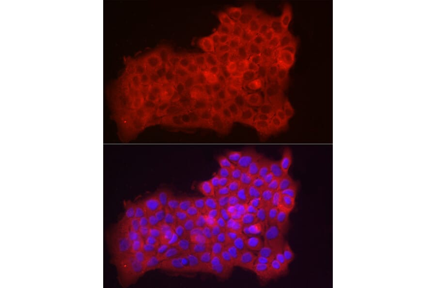 Immunofluorescence - Anti-Fbx32 Antibody (A14404) - Antibodies.com