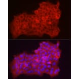Immunofluorescence - Anti-Fbx32 Antibody (A14404) - Antibodies.com