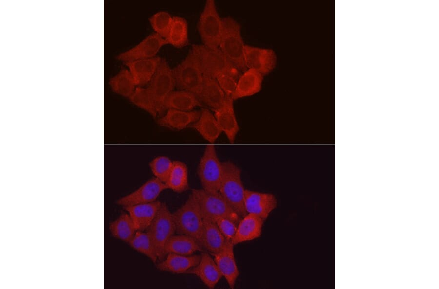 Immunofluorescence - Anti-Fbx32 Antibody (A14404) - Antibodies.com