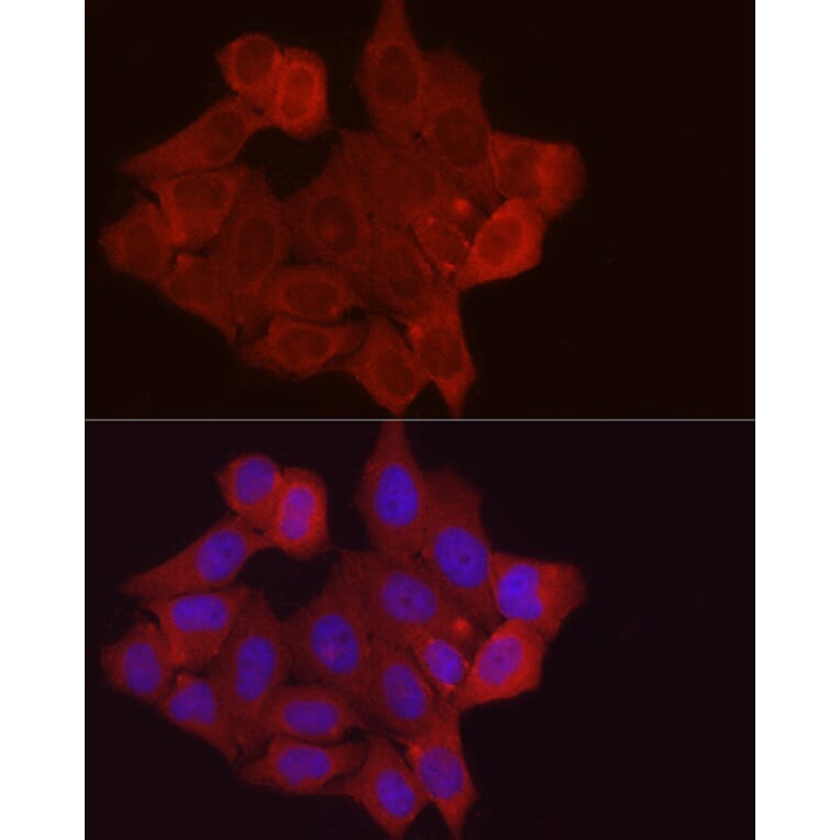 Immunofluorescence - Anti-Fbx32 Antibody (A14404) - Antibodies.com