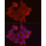 Immunofluorescence - Anti-Fbx32 Antibody (A14404) - Antibodies.com