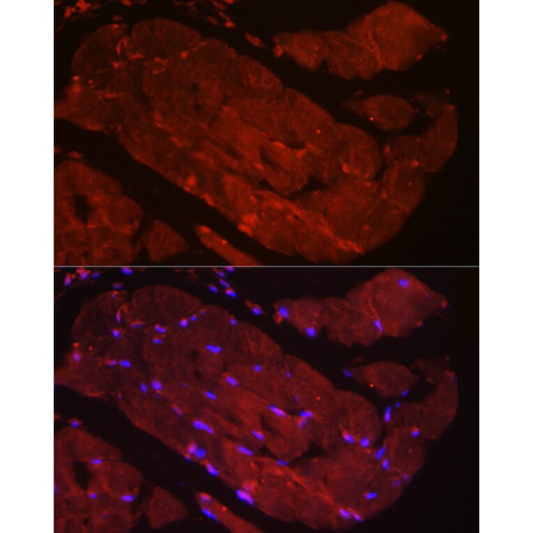 Immunofluorescence - Anti-Fbx32 Antibody (A14404) - Antibodies.com