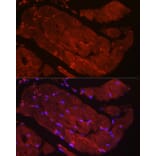 Immunofluorescence - Anti-Fbx32 Antibody (A14404) - Antibodies.com