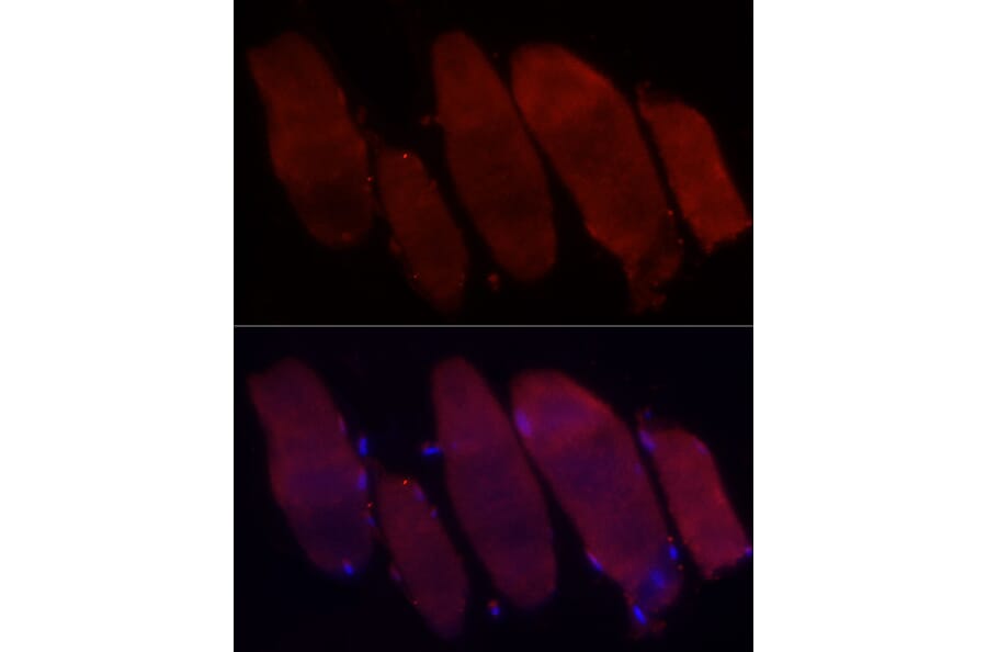 Immunofluorescence - Anti-Fbx32 Antibody (A14404) - Antibodies.com