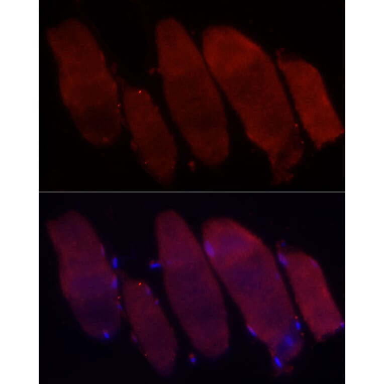 Immunofluorescence - Anti-Fbx32 Antibody (A14404) - Antibodies.com