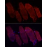 Immunofluorescence - Anti-Fbx32 Antibody (A14404) - Antibodies.com