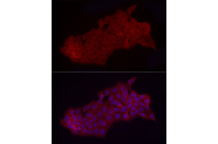 Immunofluorescence - Anti-Fbx32 Antibody (A14404) - Antibodies.com