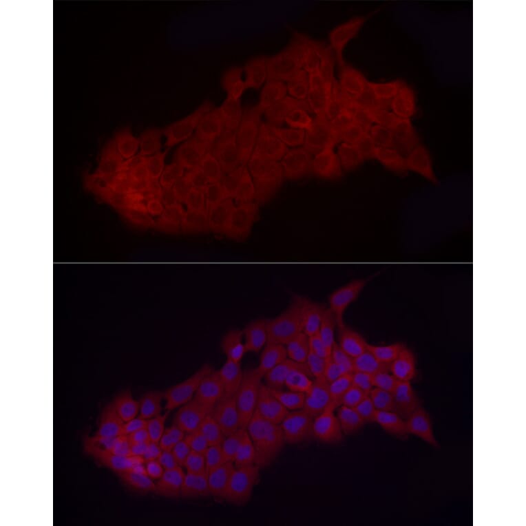 Immunofluorescence - Anti-Fbx32 Antibody (A14404) - Antibodies.com
