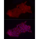 Immunofluorescence - Anti-Fbx32 Antibody (A14404) - Antibodies.com