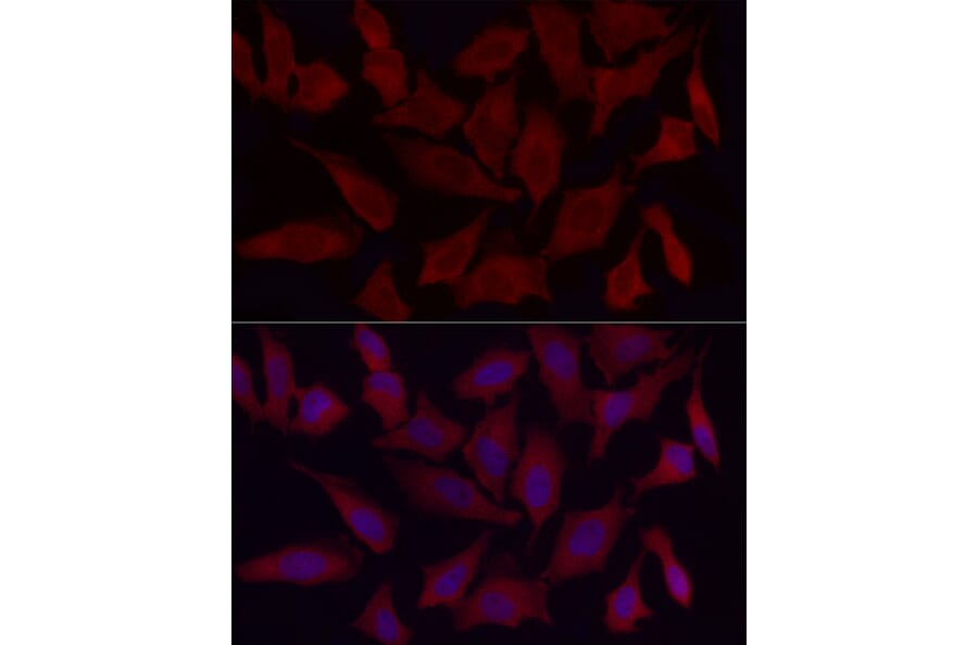 Immunofluorescence - Anti-Fbx32 Antibody (A14404) - Antibodies.com