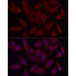 Immunofluorescence - Anti-Fbx32 Antibody (A14404) - Antibodies.com