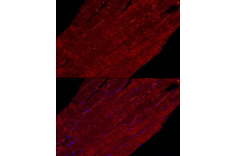 Immunofluorescence - Anti-Fbx32 Antibody (A14404) - Antibodies.com