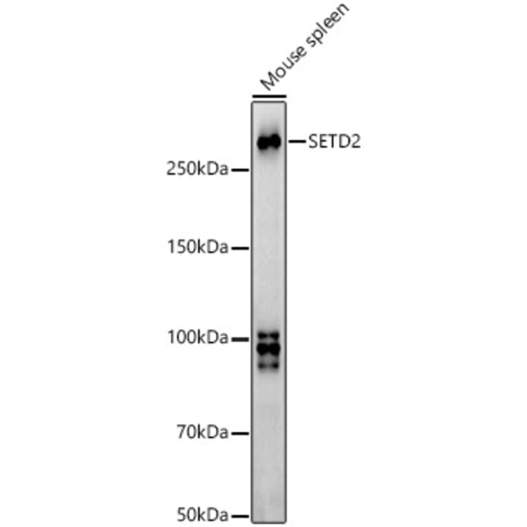 Western Blot - Anti-KMT3A/HYPB/HIF-1 Antibody (A14405) - Antibodies.com