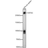 Western Blot - Anti-KMT3A/HYPB/HIF-1 Antibody (A14405) - Antibodies.com