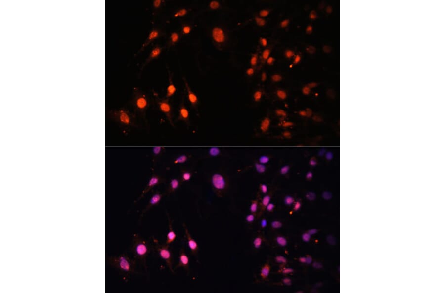 Immunofluorescence - Anti-KMT3A/HYPB/HIF-1 Antibody (A14405) - Antibodies.com