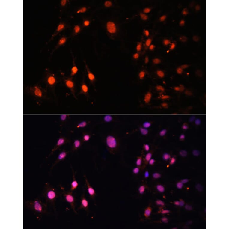 Immunofluorescence - Anti-KMT3A/HYPB/HIF-1 Antibody (A14405) - Antibodies.com