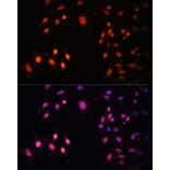 Immunofluorescence - Anti-KMT3A/HYPB/HIF-1 Antibody (A14405) - Antibodies.com