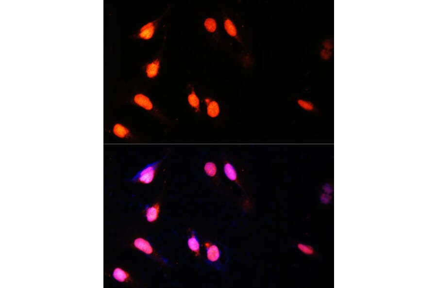 Immunofluorescence - Anti-KMT3A/HYPB/HIF-1 Antibody (A14405) - Antibodies.com