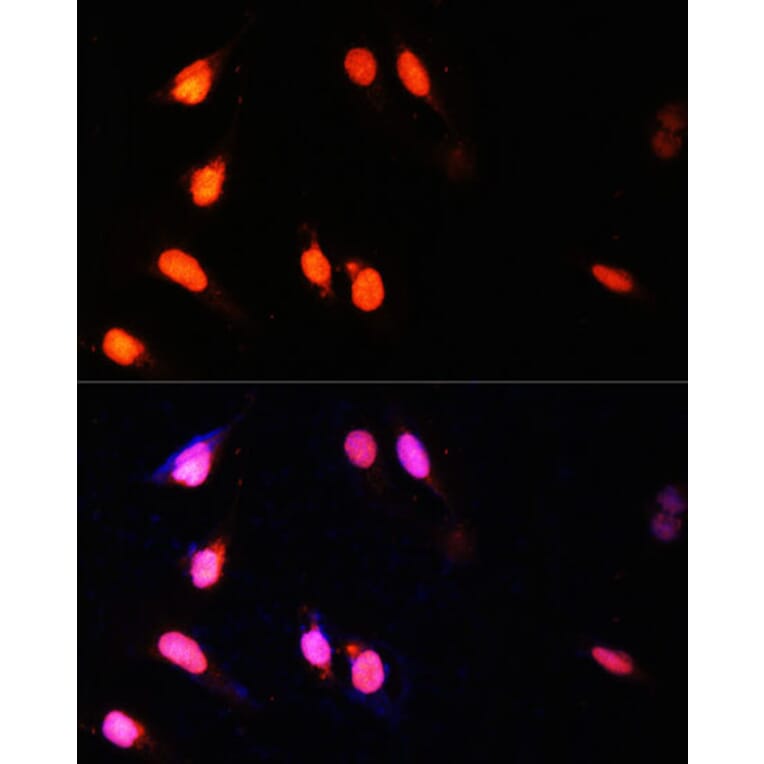 Immunofluorescence - Anti-KMT3A/HYPB/HIF-1 Antibody (A14405) - Antibodies.com