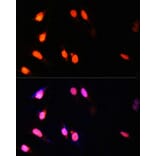 Immunofluorescence - Anti-KMT3A/HYPB/HIF-1 Antibody (A14405) - Antibodies.com