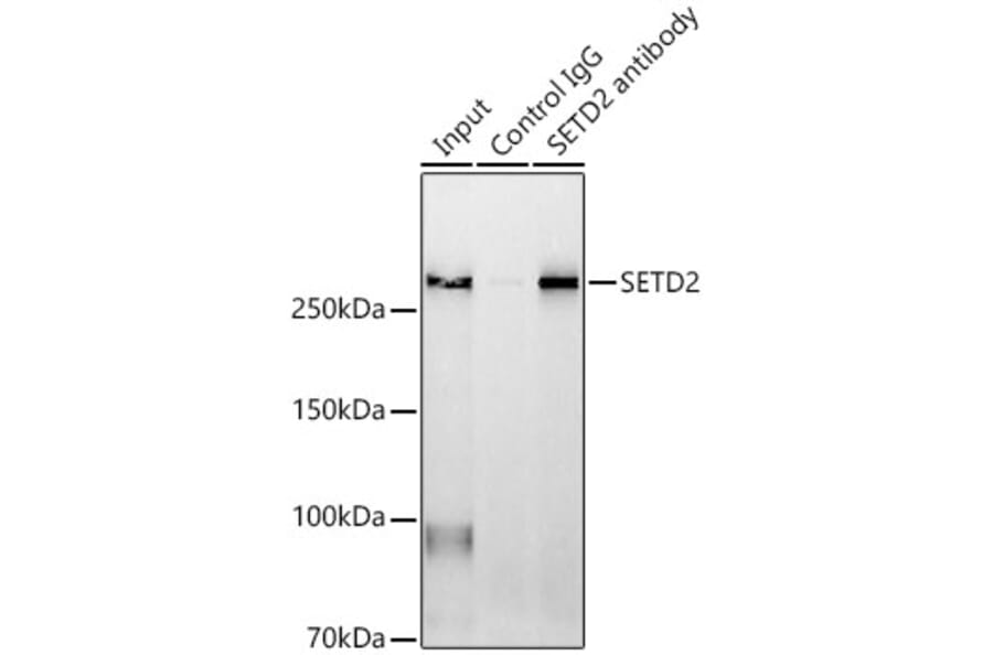 Western Blot - Anti-KMT3A/HYPB/HIF-1 Antibody (A14405) - Antibodies.com