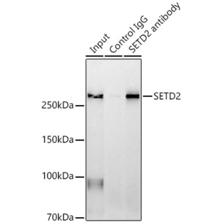 Western Blot - Anti-KMT3A/HYPB/HIF-1 Antibody (A14405) - Antibodies.com