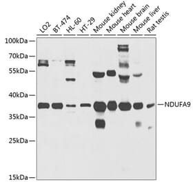 Western Blot - Anti-NDUFA9 Antibody (A14406) - Antibodies.com