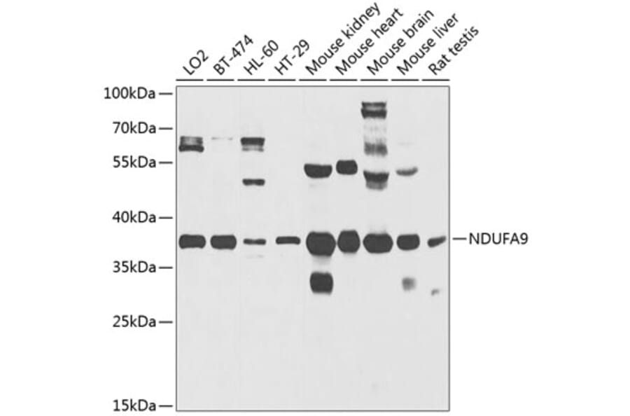 Western Blot - Anti-NDUFA9 Antibody (A14406) - Antibodies.com