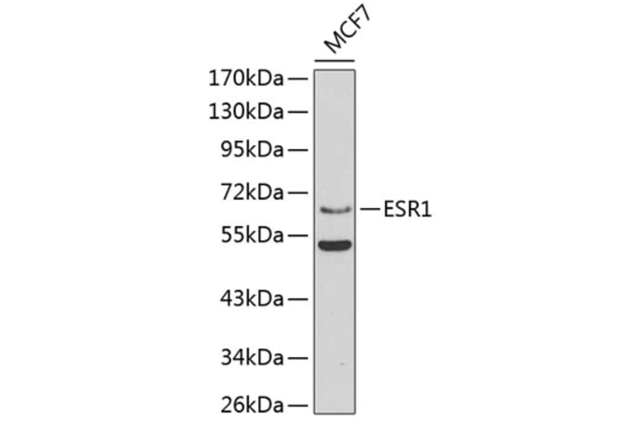 Western Blot - Anti-ESR1 Antibody (A3198) - Antibodies.com