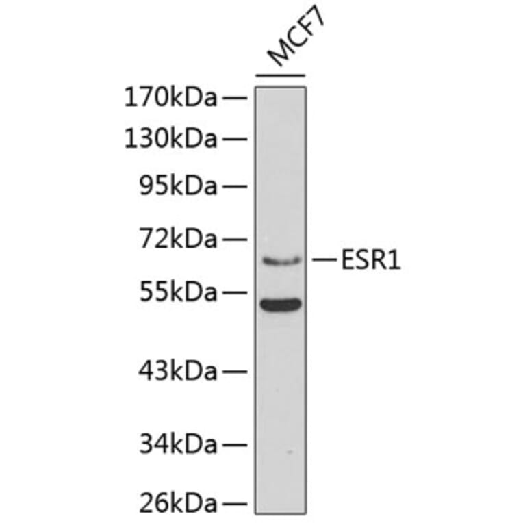Western Blot - Anti-ESR1 Antibody (A3198) - Antibodies.com