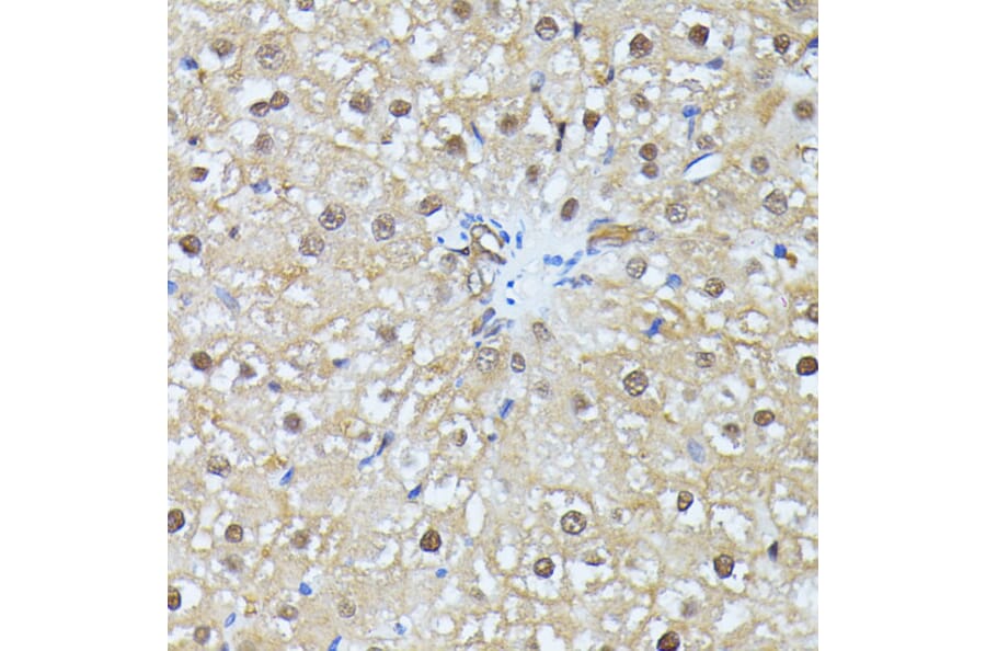 Immunohistochemistry - Anti-Ubiquitin Antibody (A14408) - Antibodies.com