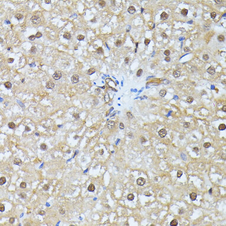 Immunohistochemistry - Anti-Ubiquitin Antibody (A14408) - Antibodies.com