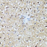 Immunohistochemistry - Anti-Ubiquitin Antibody (A14408) - Antibodies.com