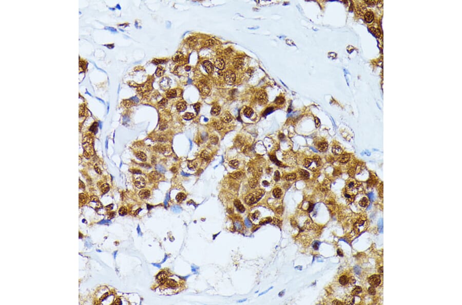 Immunohistochemistry - Anti-Ubiquitin Antibody (A14408) - Antibodies.com