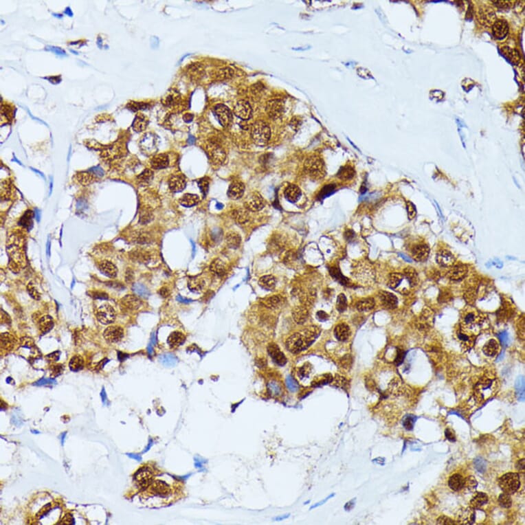 Immunohistochemistry - Anti-Ubiquitin Antibody (A14408) - Antibodies.com