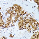 Immunohistochemistry - Anti-Ubiquitin Antibody (A14408) - Antibodies.com
